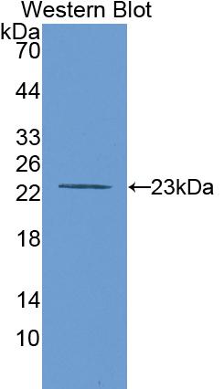 Polyclonal Antibody to Matrix Metalloproteinase 12 (MMP12)