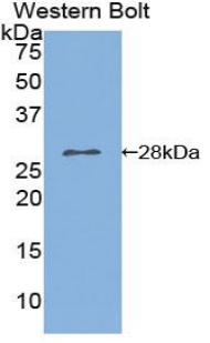 Polyclonal Antibody to Phospholipase A2, Calcium Independent (iPLA2)