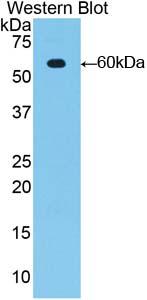 Polyclonal Antibody to Mucin 1 (MUC1)