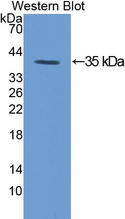 Polyclonal Antibody to Protein Kinase C Gamma (PKCg)