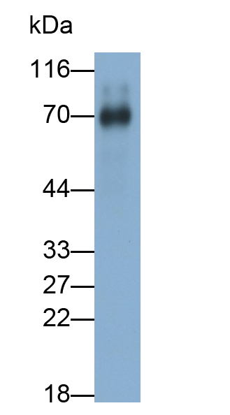 PAA422Hu01.jpg