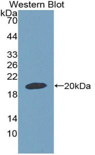 Polyclonal Antibody to Growth Differentiation Factor 9 (GDF9)