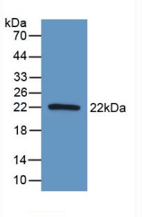 Polyclonal Antibody to Apoptosis Associated Tyrosine Kinase (AATK)