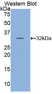 Polyclonal Antibody to Apoptosis Associated Tyrosine Kinase (AATK)