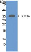 Polyclonal Antibody to Sirtuin 2 (SIRT2)