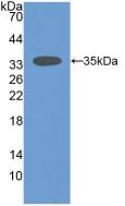 Polyclonal Antibody to Sirtuin 2 (SIRT2)