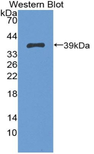 PAA434Hu01.jpg