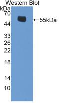 Polyclonal Antibody to Estrogen Receptor Beta (ERb)