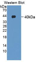 Polyclonal Antibody to Growth Hormone Releasing Hormone (GHRH)