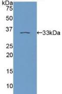 Polyclonal Antibody to Protein Kinase C Epsilon (PKCe)