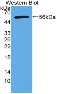 Polyclonal Antibody to Apoptosis Antagonizing Transcription Factor (AATF)