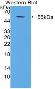 Polyclonal Antibody to Apoptosis Antagonizing Transcription Factor (AATF)