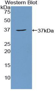 Polyclonal Antibody to Apoptosis Antagonizing Transcription Factor (AATF)