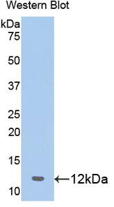 Polyclonal Antibody to Prohibitin (PHB)