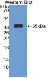 Polyclonal Antibody to Plakophilin 2 (PKP2)