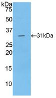 Polyclonal Antibody to Lipase, Endothelial (LIPG)