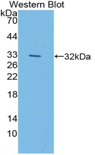 Polyclonal Antibody to Lipase, Endothelial (LIPG)