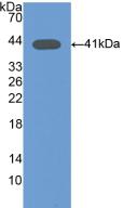 Polyclonal Antibody to Osteocalcin (OC)