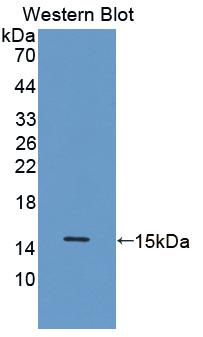 Polyclonal Antibody to Calcitonin (CT)