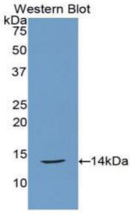 Polyclonal Antibody to Calcitonin (CT)