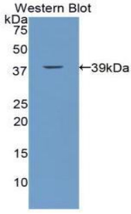 Polyclonal Antibody to Calcitonin (CT)