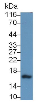 Polyclonal Antibody to Calcitonin (CT)