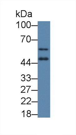 Polyclonal Antibody to Vitamin D Receptor (VDR)