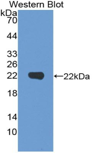 Polyclonal Antibody to Vitamin D Receptor (VDR)