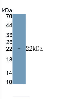 Polyclonal Antibody to Vitamin D Receptor (VDR)