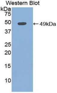 Polyclonal Antibody to Myoglobin (MYO)