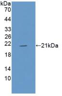 Polyclonal Antibody to Myoglobin (MYO)