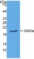 Polyclonal Antibody to Lymphotoxin Beta Receptor (LTbR)