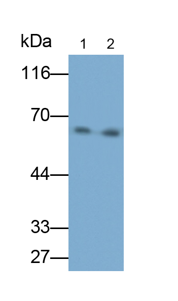 Polyclonal Antibody to Lymphotoxin Beta Receptor (LTbR)