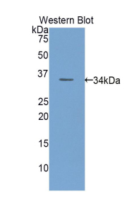 Polyclonal Antibody to Endothelin Converting Enzyme 1 (ECE1)