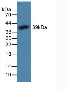 Polyclonal Antibody to N-Terminal Pro-Brain Natriuretic Peptide (NT-ProBNP)