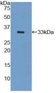 Polyclonal Antibody to Cytokeratin 5 (CK5)