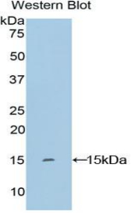 Polyclonal Antibody to Keratin 2 (CK2)