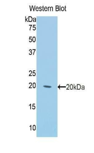 Polyclonal Antibody to Keratin 2 (CK2)