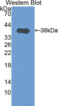 Polyclonal Antibody to Cytokeratin 1 (CK1)