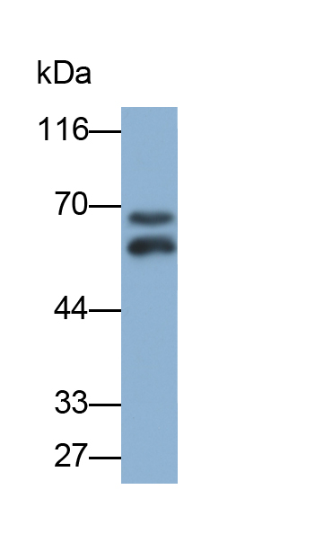 Polyclonal Antibody to Cytokeratin 1 (CK1)