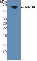 Polyclonal Antibody to Protein Kinase C Theta (PKCq)