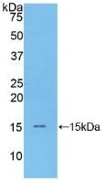 Polyclonal Antibody to Natriuretic Peptide Precursor B (NPPB)