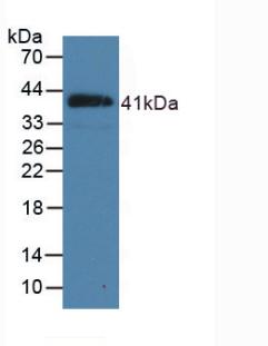 Polyclonal Antibody to Natriuretic Peptide Precursor B (NPPB)