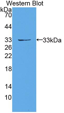 Polyclonal Antibody to Protein Kinase D1 (PKD1)