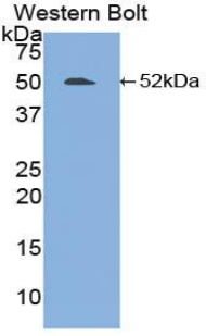 Polyclonal Antibody to Fibrinogen Like Protein 2 (FGL2)