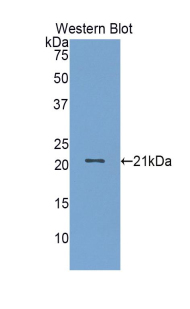 Polyclonal Antibody to Fibrinogen Like Protein 2 (FGL2)