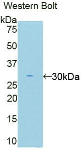 Polyclonal Antibody to Protein Kinase R (PKR)