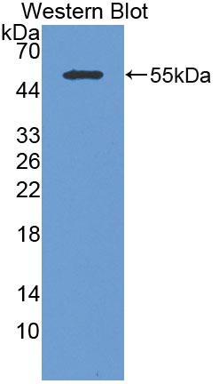 Polyclonal Antibody to Cytokeratin 14 (CK14)