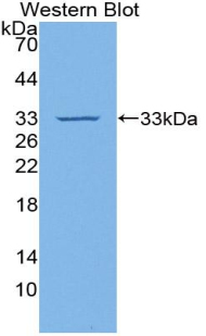 Polyclonal Antibody to Tissue Factor (TF)