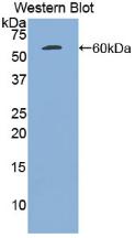 Polyclonal Antibody to Tissue Plasminogen Activator (tPA)